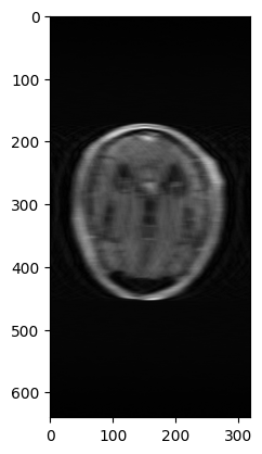 ../../_images/tutorials_mri_restoration_mri_restoration_16_0.png