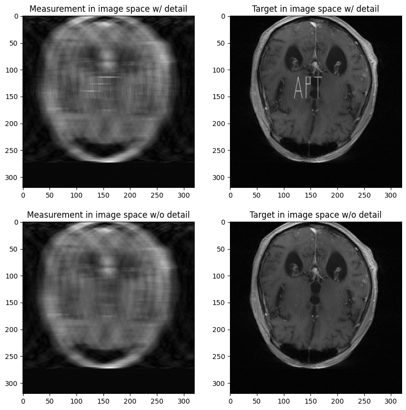 ../../_images/tutorials_mri_restoration_mri_restoration_23_0.png