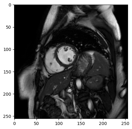 ../../_images/tutorials_mri_restoration_mri_restoration_35_0.png