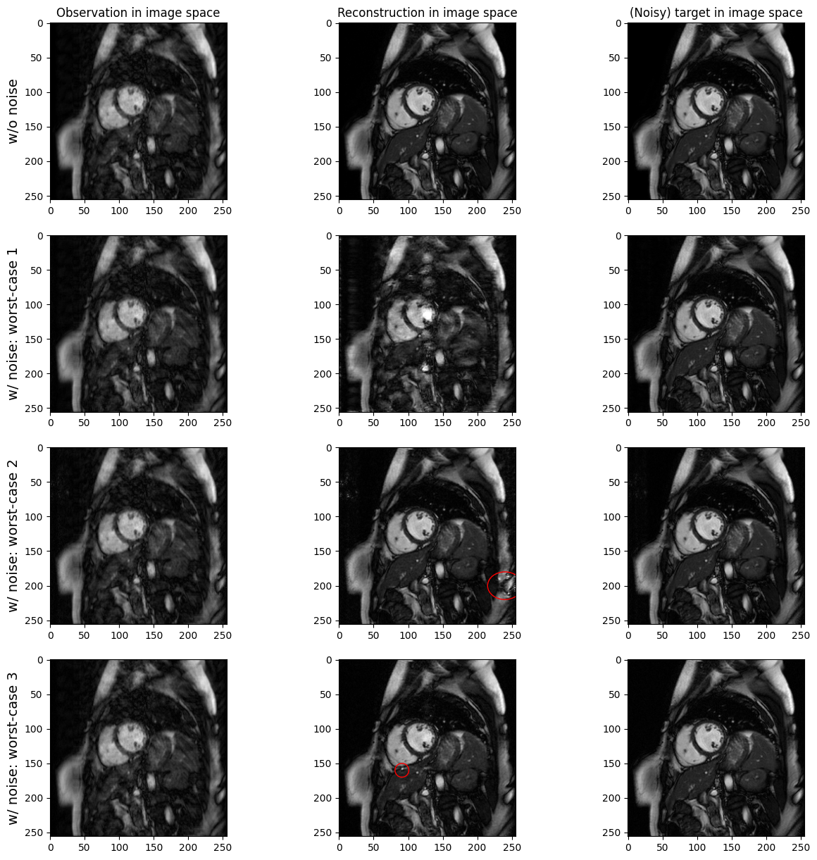 ../../_images/tutorials_mri_restoration_mri_restoration_41_0.png