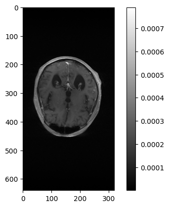 ../../_images/tutorials_mri_restoration_mri_restoration_9_0.png